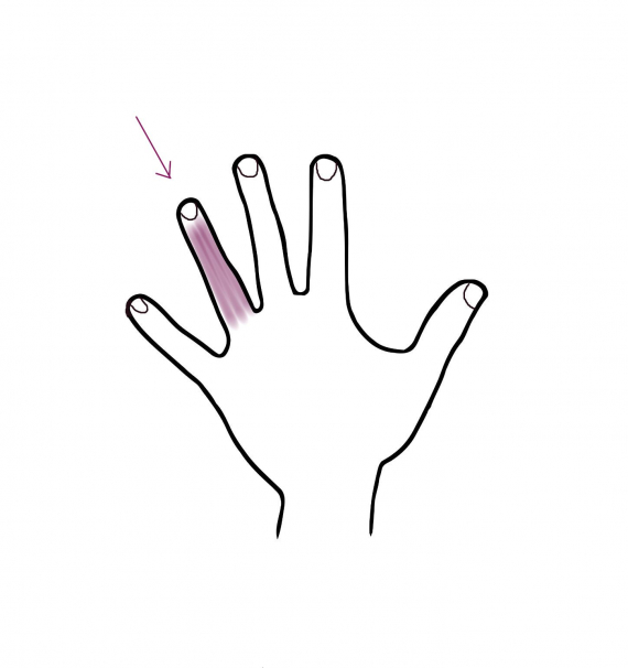 Tegning av en hånd med fokus på ringfingeren.