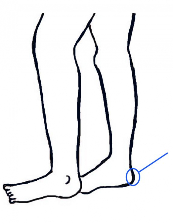Tegning av bein med fokus på hælen.