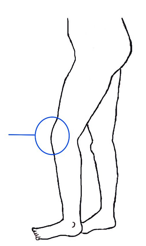 Tegning av bein med fokus på et kne.