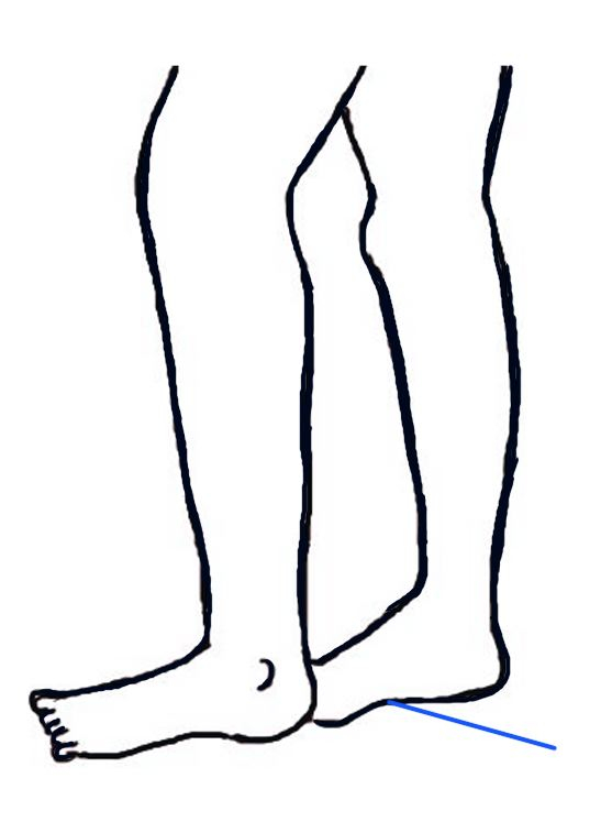 Tegning av føtter med fokus på fotsålene.
