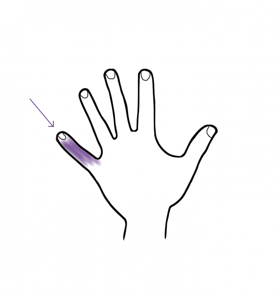 Tegning av en hånd med fokus på lillefingeren.