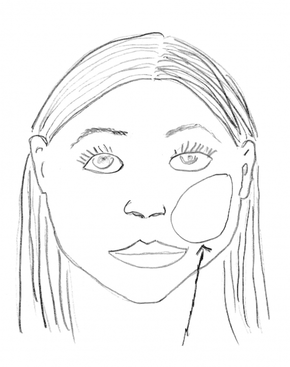 Tegning av et ansikt med fokus på kinnet.