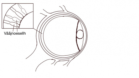 Tegning av øyeeplet med fokus på synsceller.